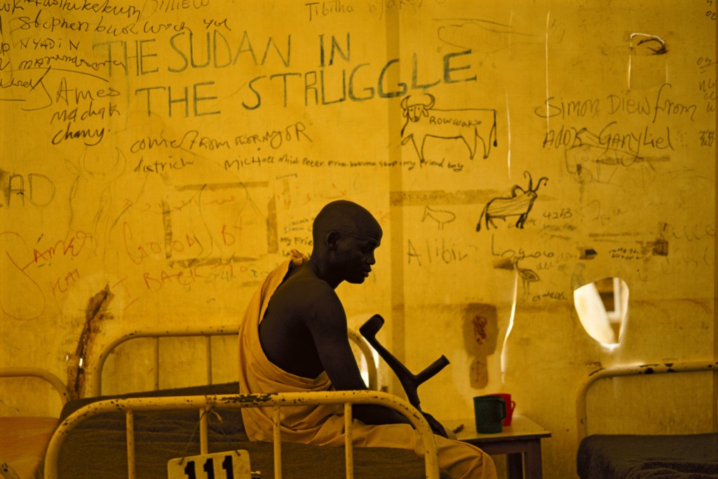 The ICRC (Red Cross) hospital at Lopiding, part of the international relief complex centered at Lokichokio in northwest Kenya. The 500-bed hospital has treated the wounded from both rebel and government sides, as well as civilians.  Loss of limbs is common among soldiers brought here for treament, and prosthetics are designed, manufactured and fitted here. Above right, surgery on a child in one of the hospitals operating theatres.